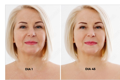 Masajeador facial con microcorriente